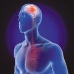 Homocysteine: The Facts