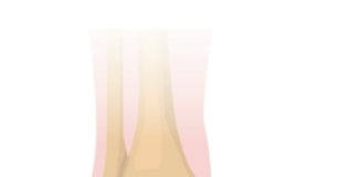 pain, redness, and swelling.