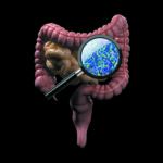 Trillions of microbes live in our bodies, most in the lower part of our gut. Scientists are just beginning to understand the complex and important role they play in our health—and how the dietary choices we make can influence their makeup.