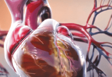 At Risk for Heart Disease? Lower Your Saturated Fat Intake