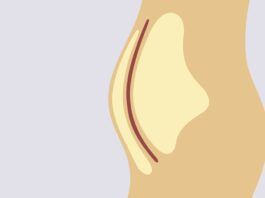 Body Roundness Index Proposed to Replace Body Mass Index