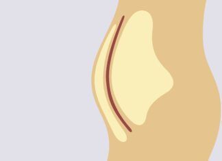 Body Roundness Index Proposed to Replace Body Mass Index