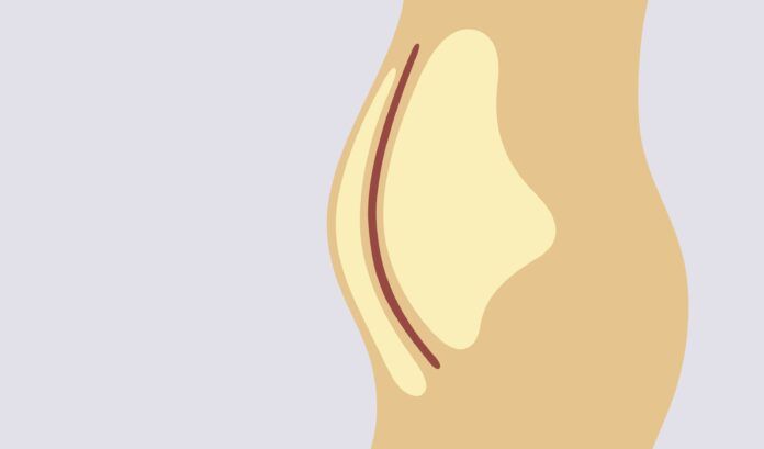 2412_HNL_gi_1402545815_no_labels