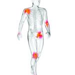 5 Arthritis Food Myths