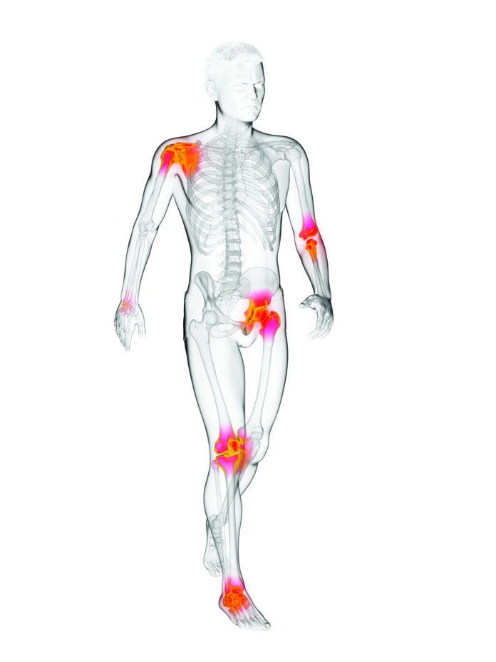 Walker's painful joints, illustration