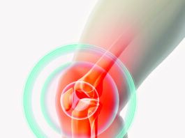 Aerobic Activity is Best for Knee Osteoarthritis